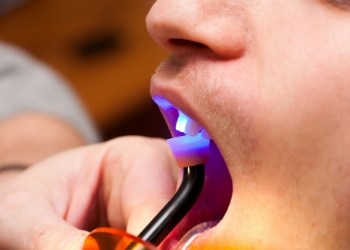 Close up of dental patient receiving dental bonding on upper front tooth