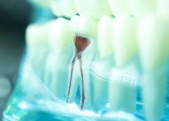 Model of tooth showing the root canals inside of it